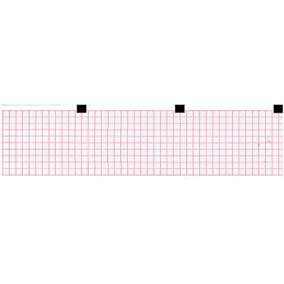 ECG Paper Z-FOLD 60MM X 75MM X 250SHEETS (Works for 66010040, CARDIETTE AR600, CARDIORAPID K130-D) (10)