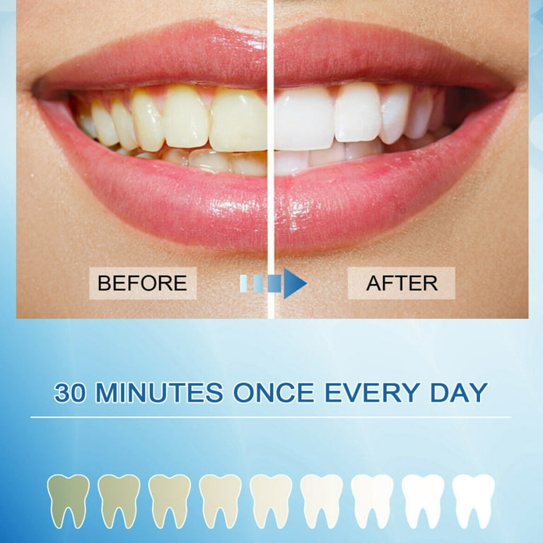 Hydrogen Peroxide Teeth Before After