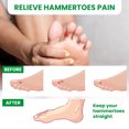 thumbnail image 5 of Bukihome 6 Pack Hammertoe Corrector Toe Straightener Curled Broken Toe Bunion Corrector for Women and Men,Size L,Clear, 5 of 7