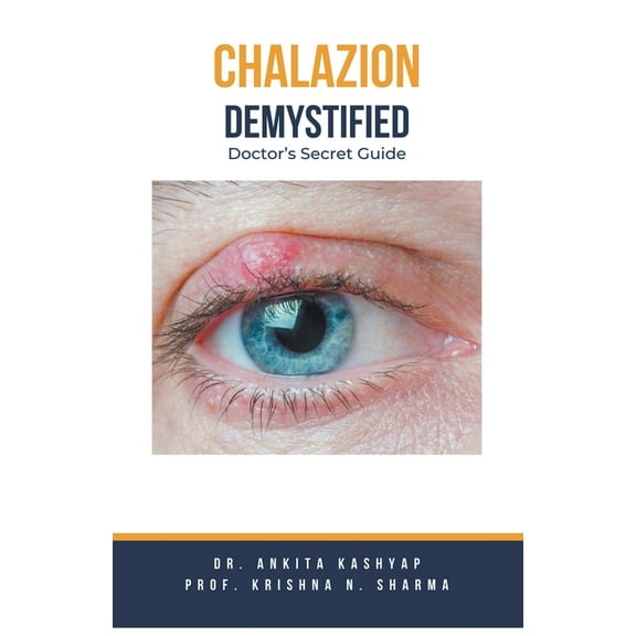Chalazion Demystified: Doctor's Secret Guide, (Paperback)
