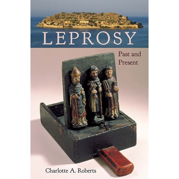 Bioarchaeological Interpretations of the Leprosy: Past and Present, (Hardcover)