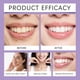 thumbnail image 3 of Polvo dental morado y quitamanchas, protección segura y limpieza, aliento fresco y limpieza, 30 g, blanqueamiento dental, 3 of 9