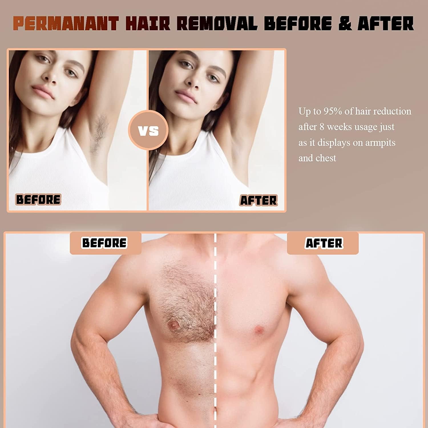 (3 pack) Yoovee IPL Laser Hair Removal Device – Ideal for Bikini Areas & Beyond,  Enhanced with 999,999 Flashes, FDA Approved