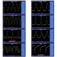 thumbnail image 4 of Generador de Señal DDS, Generador de Señal de Función de Alta Precisión 0.01Hz-500KHz Para Pruebas Electónicas de CircuitO, 4 of 7