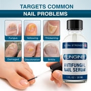FUNGINIX Toenail Fungus Treatment Extra Strength - Antifungal Nail Treatment With 10% Undecylenic Acid & Tea Tree Oil - Includes Natural Oils & Botanicals - Made in USA (Packaging Does Vary)