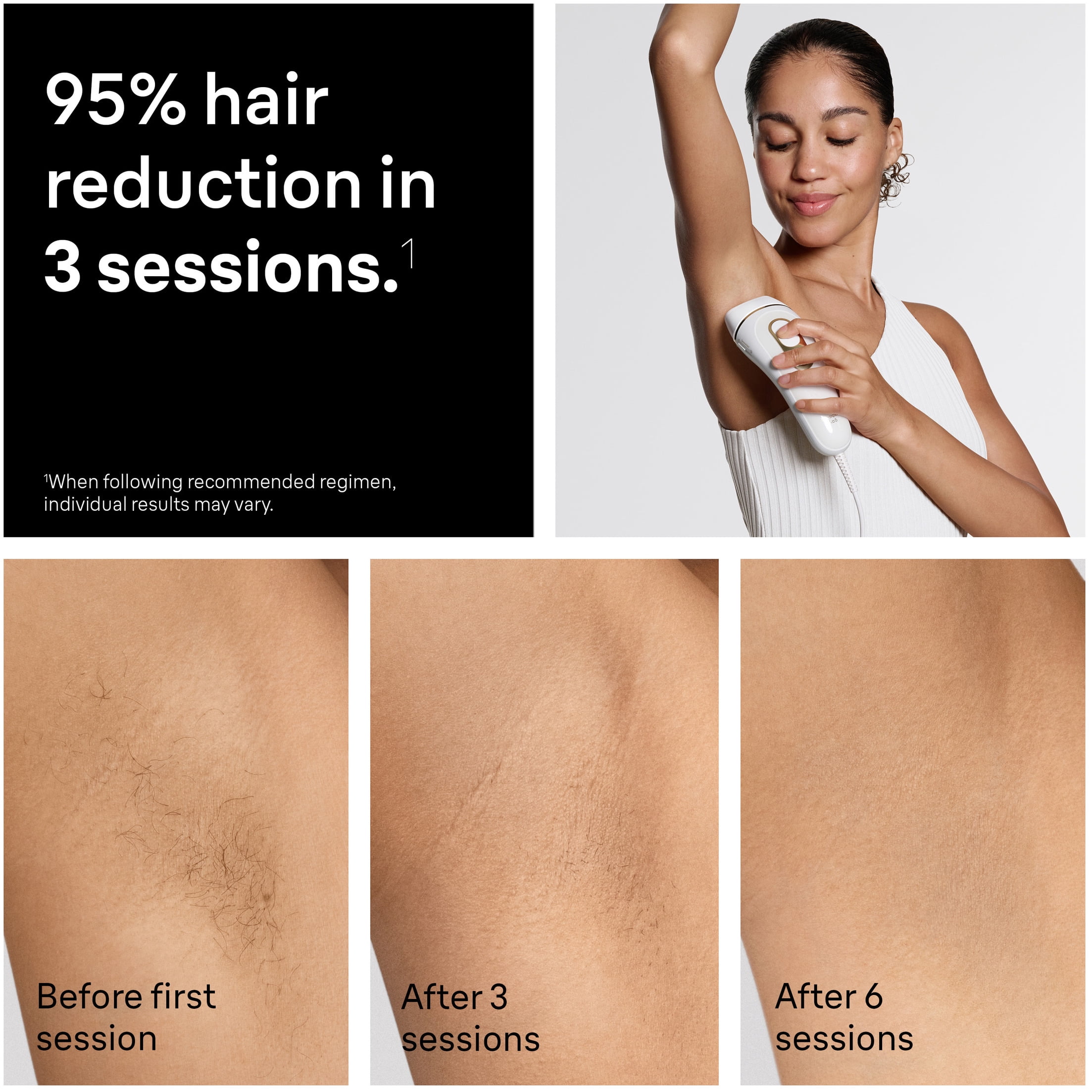 Free Shipping! Braun Silk Expert Pro 5 IPL Hair Removal for Women