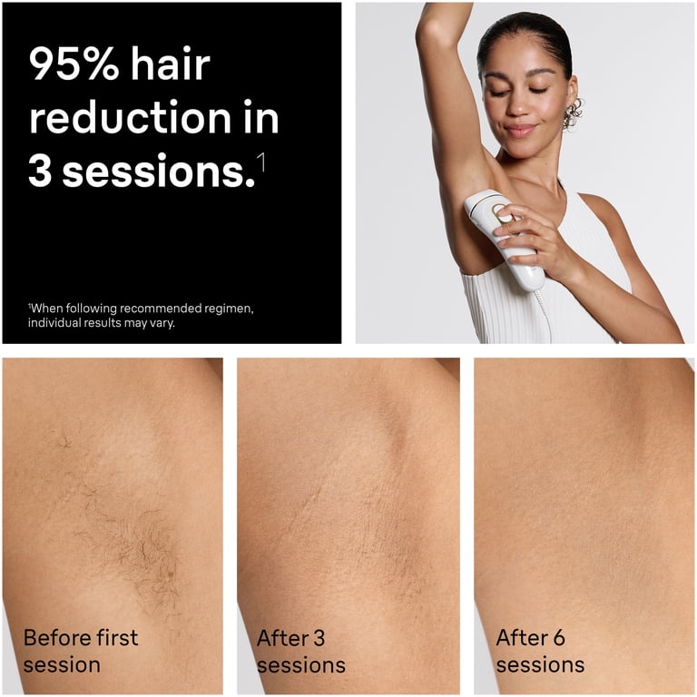 Free Shipping! Braun Silk Expert Pro 5 IPL Hair Removal for Women