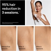 Braun Silk·expert Pro 5, PL5145 Women & Men’s IPL, At-Home Long Lasting Hair Removal