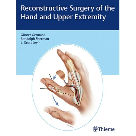 UPC: 9781626236011 | Reconstructive Surgery of the Hand and Upper Extremity (Hardcover)