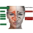 thumbnail image 1 of Aerosol nasal de planta natural para rinitis y sinusitis gotas nasales Aerosol nasal de planta natural para rinitis y sinusitis gotas nasales de 20ml para el cuidado de la salud ANGGREK Otros, 1 of 4