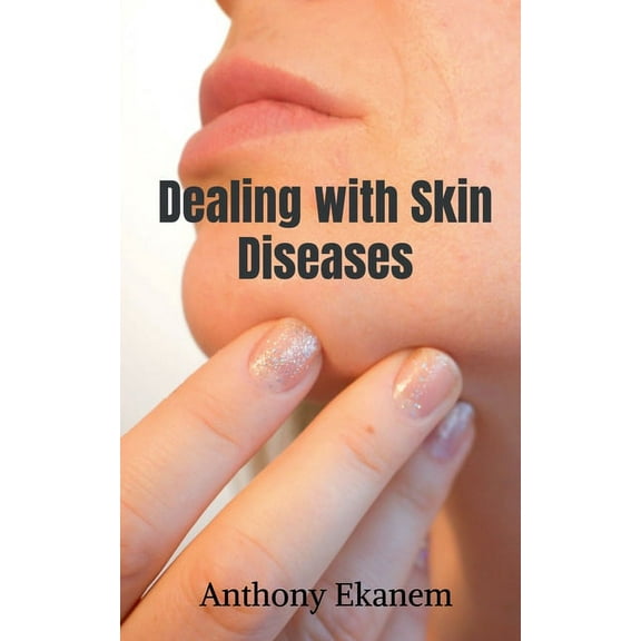 Dealing with Skin Diseases, (Paperback)