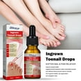 thumbnail image 4 of 10ml Ingrown Toenail Drops Fluid Soften Applying Straightening Essential Recover Fluid Oil Portable Nail Repairing Essence Accessory, 4 of 9