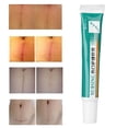 thumbnail image 4 of Crema Reparadora De Cicatrices, Ungüento Nutritivo Suave Para El Cuidado De Heridas Que Hace Que La Piel Sea Elástica Para El Cuidado De La Piel Ccdes Skin Wound Care Ointment, 4 of 8