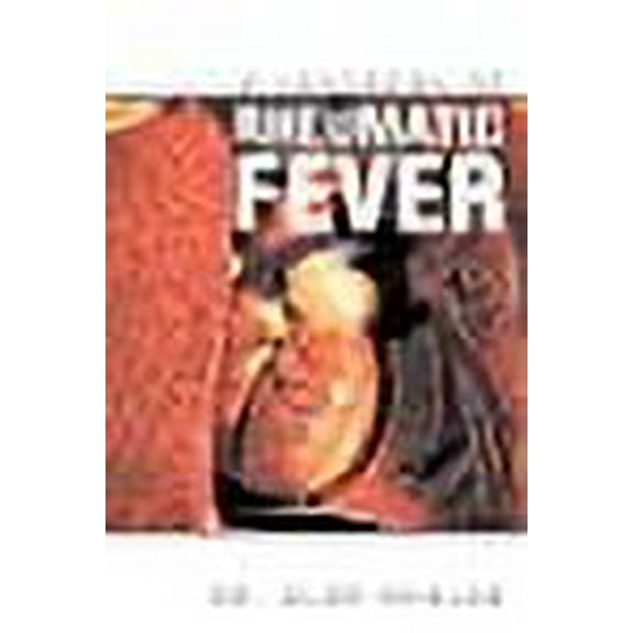 A Handbook of Rheumatic Fever