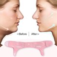 thumbnail image 3 of V Line Lifting Strap Reusable Face Tighten Belt Prevent Sagging Double Chin Eliminator for Women Men, 3 of 8