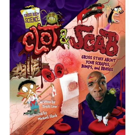 Clot & Scab - eBook (Best Way To Cover Up Scabs On Face)
