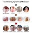 thumbnail image 4 of Crema para eliminar hongos en las uñas onicomicosis crema para hongos en las uñas pomada para el cuidado de las uñas en los dedos de los pies ANGGREK Otros, 4 of 8