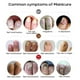 thumbnail image 4 of Crema Para Eliminar Hongos En Las Uñas, Crema Para Eliminar Hongos En Las Uñas, Onicomicosis, Crema Para Hongos En Las Uñas, Pomada Para El Cuidado De Las Uñas De Los Pies ANGGREK Nail Cream, 4 of 8
