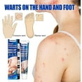 3pcs Wart Flat Wart Removal Cream Hand Foot Face Underarm Flesh Neck