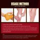 thumbnail image 4 of Spray para venas varicosas, crema para alivio de flebitis vasculitis, cuidado corporal a base de hierbas Ygjytge Cuidado Belleza, 4 of 7