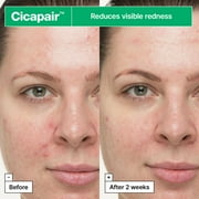 Dr.Jart+ Cicapair™ So Soothing Face Treatment for Visibly Irritated Skin with Centella Asiatica | Skin Barrier Repair | Korean Skin Care, 1.01 Fl Oz C80