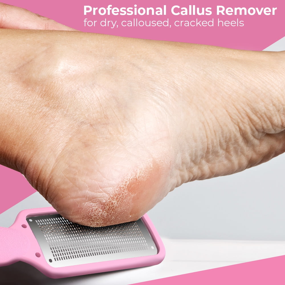 Buy Nylea Foot File Callus Remover, Foot Rasp to Remove Hard Skin on