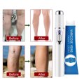 Varicose Veins Blue Light Therapy Set Varicose Vein Cream and Blue