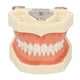 thumbnail image 2 of Modelo dental de quiste ANGGREK 28 Dientes fijación de Tornillos encías Blandas, 2 of 7
