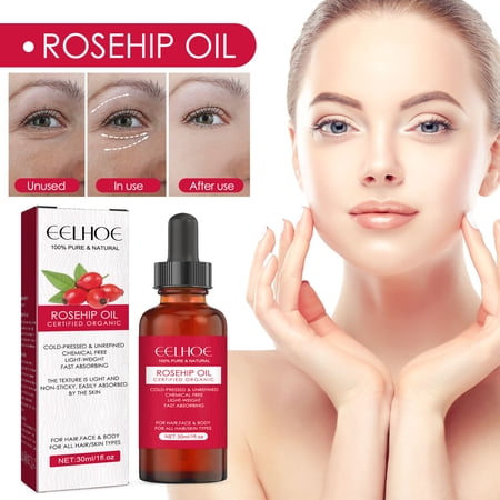 EELHOE Rosehip Facial Oil, Facial Body Skin Care Moisturizing Moisturizing Soft Hair Care Massage Oil
