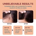 thumbnail image 2 of 1-3x 120ML Raw Batana Oil for Hair Growth - 100% Pure, Organic Batana Oil for Thicker and Stronger Hair, Unrefined Batana Oil Prevent Hair Loss, 2 of 5
