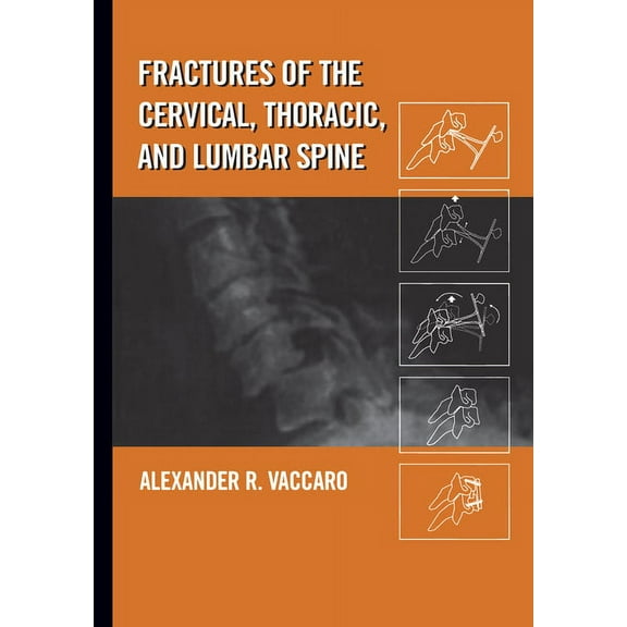 Fractures of the Cervical, Thoracic, and Lumbar Spine, (Hardcover)