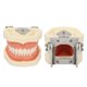 thumbnail image 5 of Modelo dental de quiste ANGGREK 28 Dientes fijación de Tornillos encías Blandas, 5 of 7