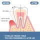 thumbnail image 4 of Pasta de dientes, Pasta de dientes blanqueadora, Pasta de dientes reparadora de dientes Reparar encías inflamadas Limpiar manchas Encías Blanquear dientes Cuidado bucal 30 ml una pasta de dientes, 4 of 5