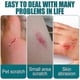 thumbnail image 3 of Waterproof Quick-Dry Gel for Wound Care, Breathable Liquid Bandage for Cracked Skin and Scrapes, 3 of 5