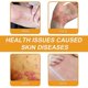 thumbnail image 4 of 3Pcs Bienengift Psoriasis Behandlungs Creme Australia Bee Venom Psoriasis Treatment Cream, 4 of 5