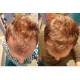 thumbnail image 4 of DIY AHK Copper Peptide Solution AHK-Cu Scalp Hair, 4 of 10