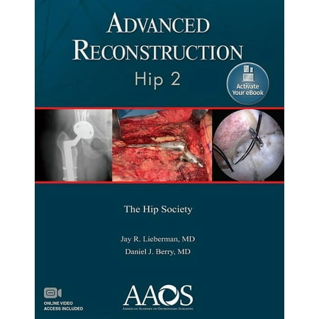 UPC: 9781975123833 | AAOS – American Academy of Orthopaedic Surgeons: Advanced Reconstruction: Hip 2: Print + eBook with Multimedia (Paperback)