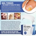 thumbnail image 5 of 1-2PCS LED Nail Fungus Laser Treatment Device for Damaged ToenailsOnychomycosis Buster, 5 of 5