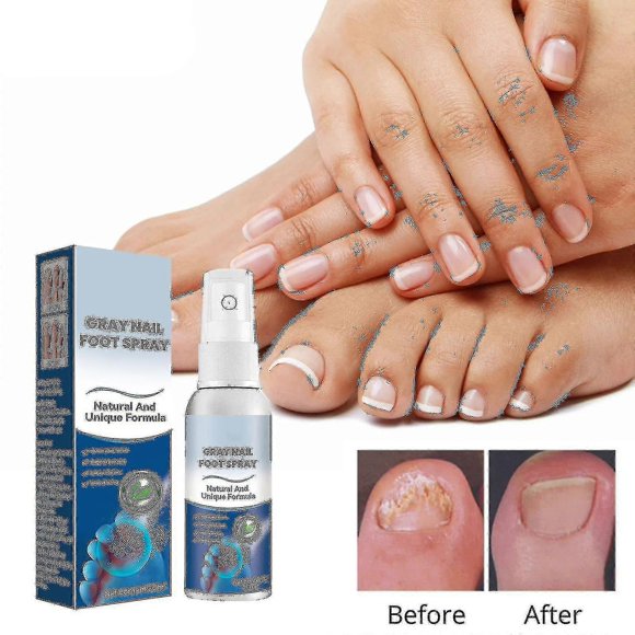 Gray Nail Foot Spray, Nail Fungus Foot Spray, Athlete Foot Treatment Spray, Effectively Relieves Foot Odour 30ml
