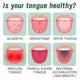 thumbnail image 5 of 30ml Tongue Repair Oral Health Spray, Dry Mouth Relief Spray Gentle, Oral Care Solution for Freshing Breath Comfort for Men & Women, 5 of 5