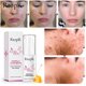 thumbnail image 1 of Hot6sl Ofertas y Liquidaciones Propóleo Anti-, Hidratante y Nutritivo, Anti-, Antiinflamatorio y Antihinchazón 20Ml, 1 of 7