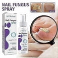 thumbnail image 2 of 3pcs 100ml Medinail Fungus Repair Spray For Foot,nail, Soft Nail, Yellow Hair Care, 2 of 5