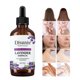 thumbnail image 1 of Teissuly Essential Oil Skin Care Oil Essential Natural Aromatherapy Essential Oil 10ml Aroma Unilateral 118ml Teissuly WER202401272566, 1 of 6