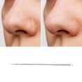 thumbnail image 5 of Unique Bargains Convenient Fine Facial Pimple Extractor 1 Pc Silver Tone, 5 of 6