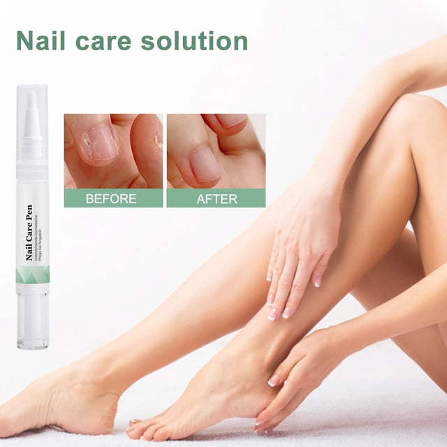 Lápiz para tratamiento de uñas limpio, aceite para cutículas de uñas, lápiz para uñas dañadas, interruptor para cutículas fortalecedor de uñas, reparación de aceite de aloe vera y árbol de té dañado