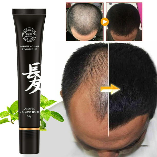 Chainplus Hair Growth Essential Oil, Professional Hair Loss Treatment, for Hair  Loss, Thinning, Regrowth and Balding, Topical Treatment for Men and Women,  Alcohol Free and Non Oily, 2Pcs 
