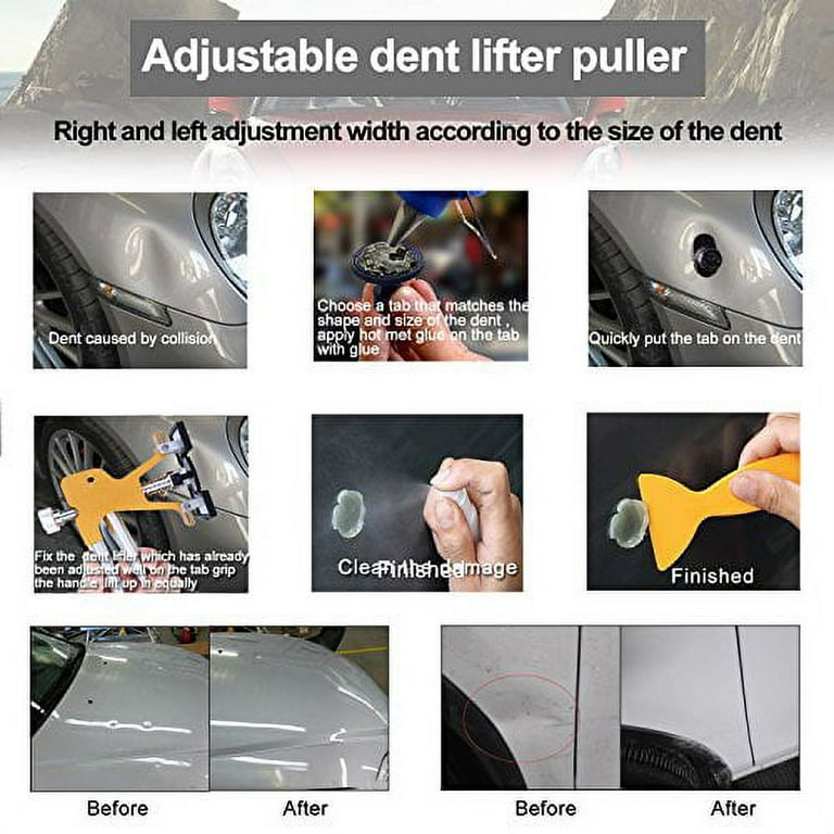 Gliston Auto Dent Puller Kit - Adjustable Golden Dent Remover Tools  Paintless Dent Repair Kit Dent Lifter Puller for Car Large & Small Ding  Hail Dent Removal 