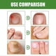 thumbnail image 5 of 1/2/3pcs Health Toenail Stick Roller Onychomycosis Care Nails Repair for Feet & Hands, Healthy Nail Solution for Women Men, 5 of 5