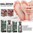 thumbnail image 2 of ExquisiteEffective Nail Fungus Treatment for Stronger Nails - Stop Fungal Growth, Repair and Renew, 2 of 5