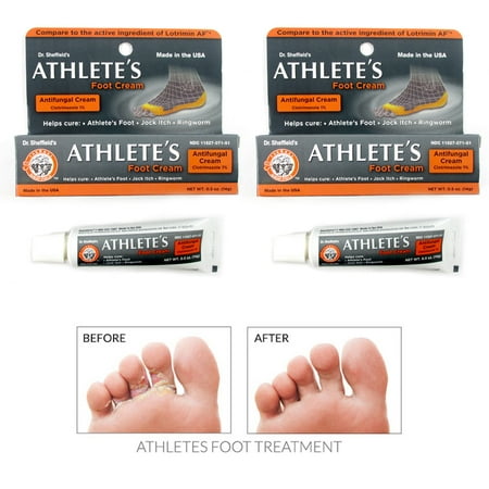 2 x 1% Clotrimazoloe Antifungal Athlete's Foot Cream 0.5 oz Ringworm Jock (The Best Antifungal Cream For Ringworm)